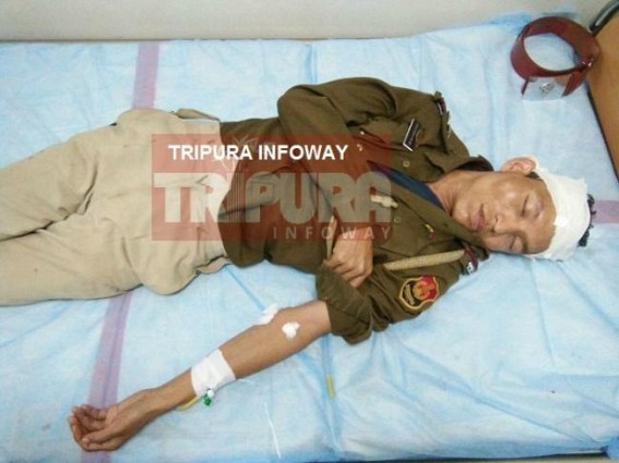 Police officials injured by IPFT at Talkarjala : Admitted in GB Police officials injured by IPFT at Talkarjala : Admitted in GB